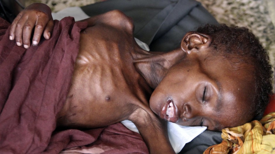 Wir lassen sie verhungern! Unser Bild des Tages aus Somalia